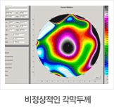 비정상적인 각막두께