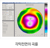 각막전면의 곡률