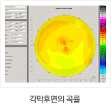 각막후의 곡률