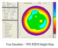 True Elevation – 각막 후면의 Height Map